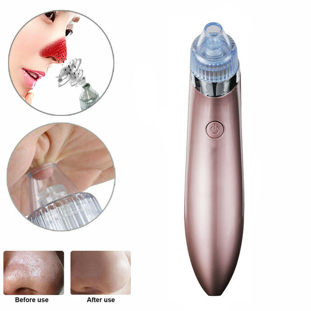 Electric Blackhead Vacuum – Pore & Acne Remover