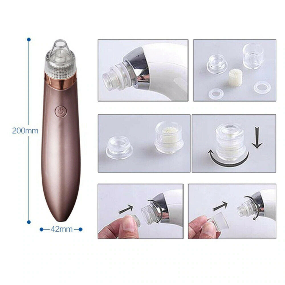 Electric Blackhead Vacuum – Pore & Acne Remover