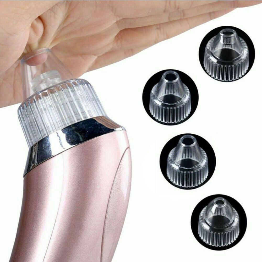 Electric Blackhead Vacuum – Pore & Acne Remover