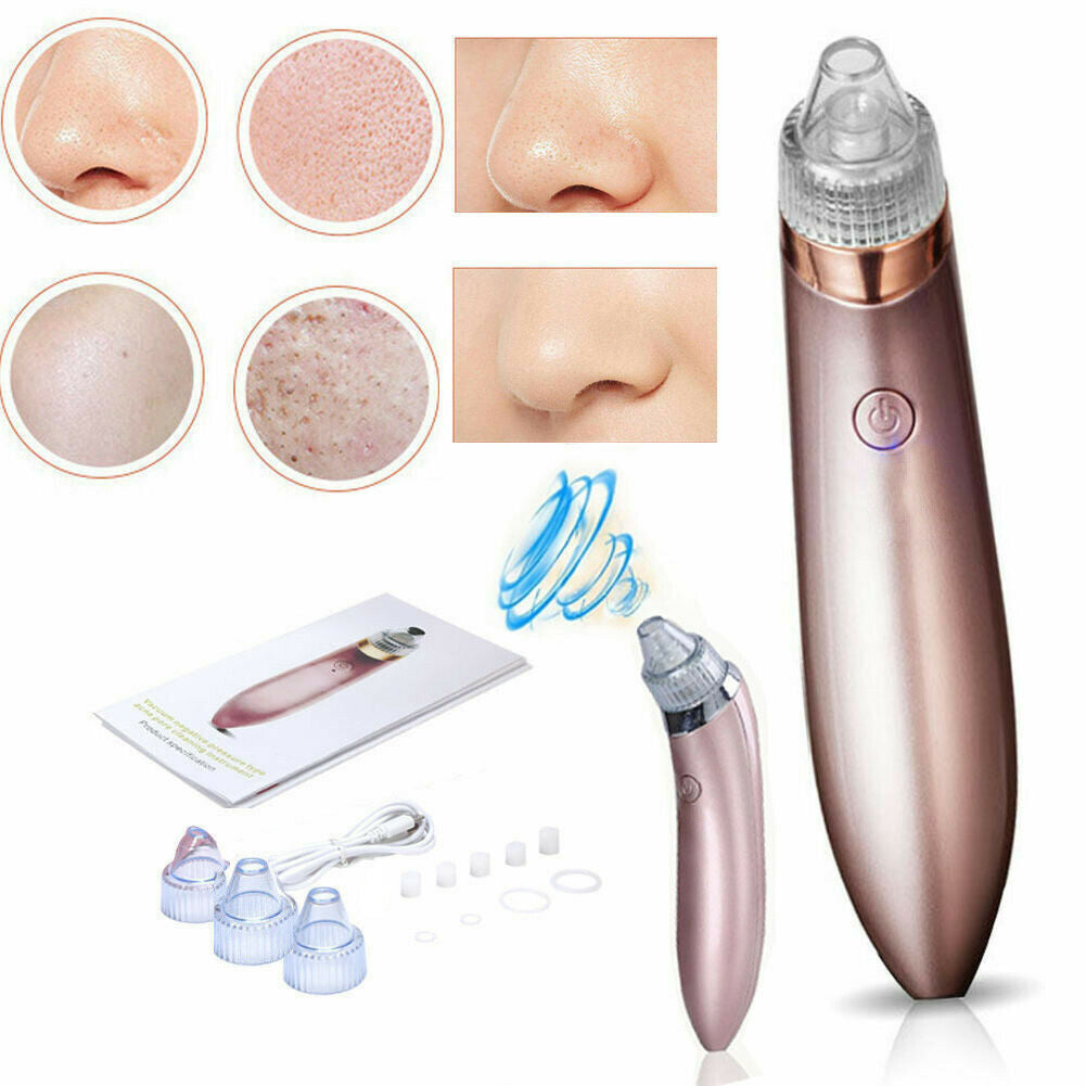 Electric Blackhead Vacuum – Pore & Acne Remover