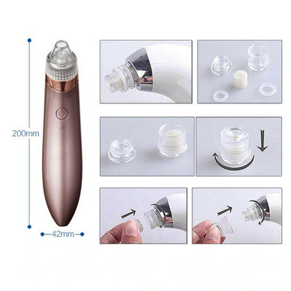 Electric Blackhead Vacuum – Pore & Acne Remover