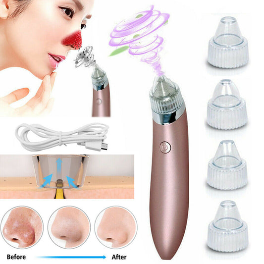 Electric Blackhead Vacuum – Pore & Acne Remover